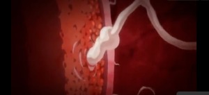 Thumbnail of post image 180